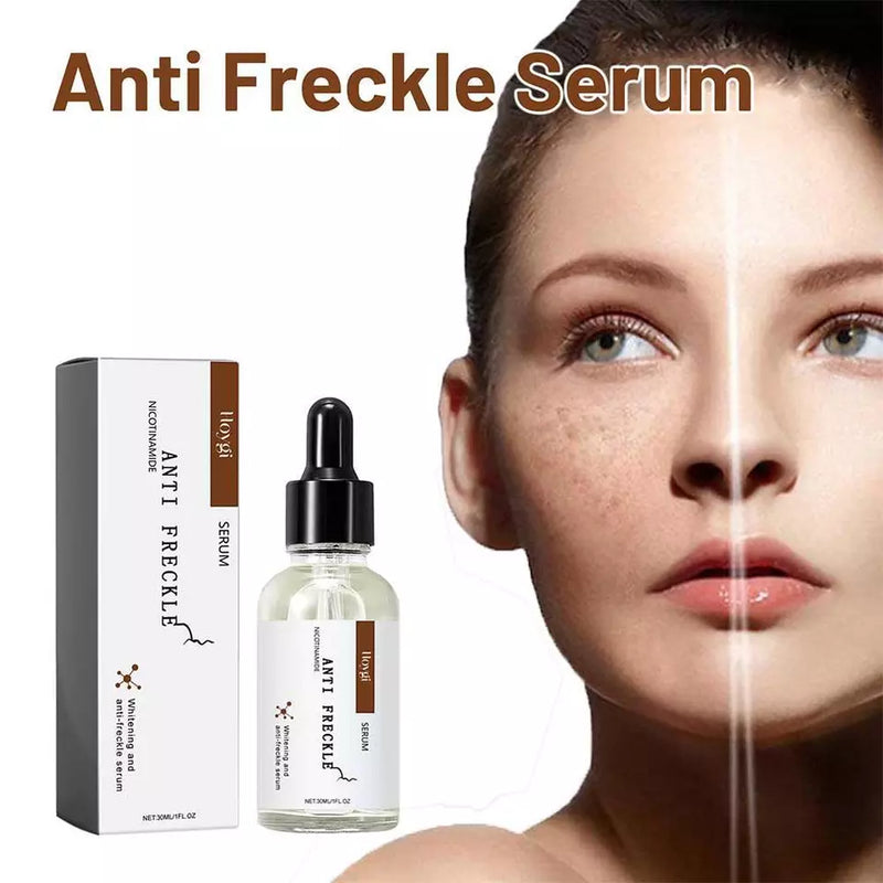 Anti-Freckle Serum (30ml) – A skin-brightening treatment designed to fade freckles, dark spots, and uneven pigmentation while deeply hydrating and protecting your skin