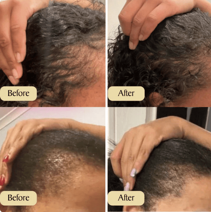 Hair Oil / Hair Growth Treatment 60ml (2.0 fl.oz.) Lightweight oil blend
